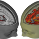 Image showing the difference between primary visual cortex communication under placebo (left) and LSD (right). Image: R. Carhart-Harris/Imperial College London